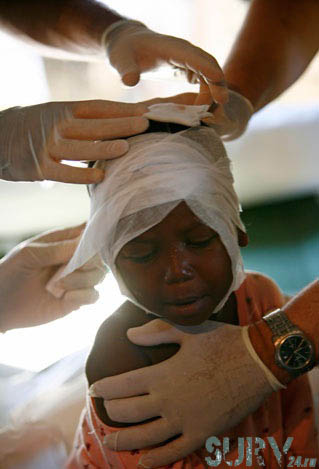 Наложение ИПП на голову